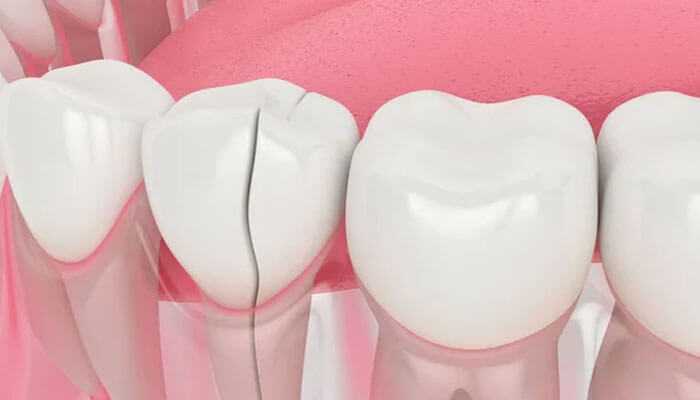 5 Dental Problems You Shouldn’t Ignore