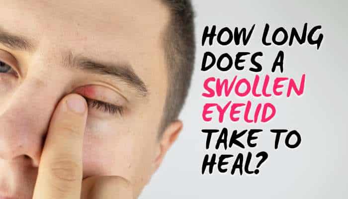 What Is the Fastest Way to Heal a Swollen Eyelid? 7 Safe Remedies